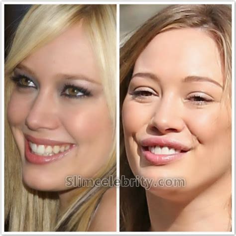 hillary duff plastic surgery|A Look At Hilary Duff’s History With Plastic Surgery